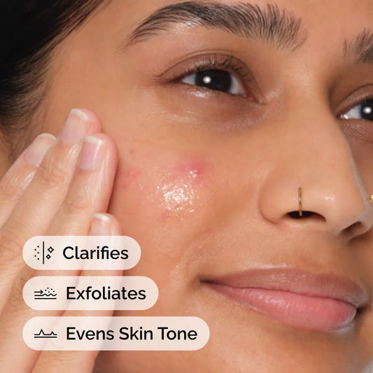 The Ordinary Salicylic Acid 2% Solution