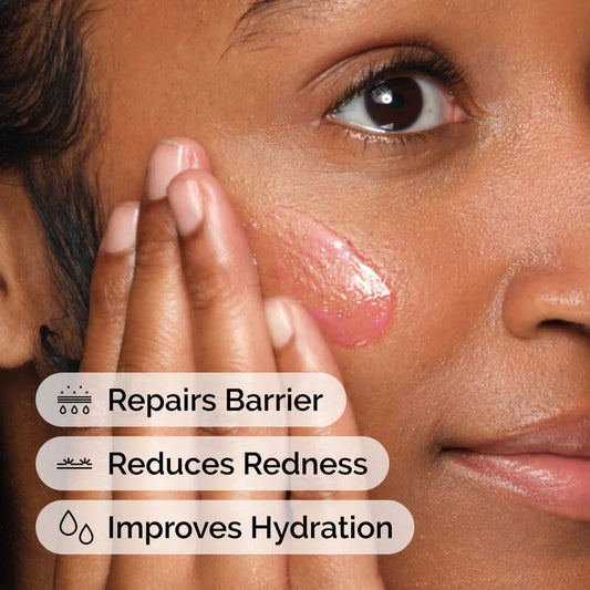 The Ordinary Soothing Barrier Support Serum