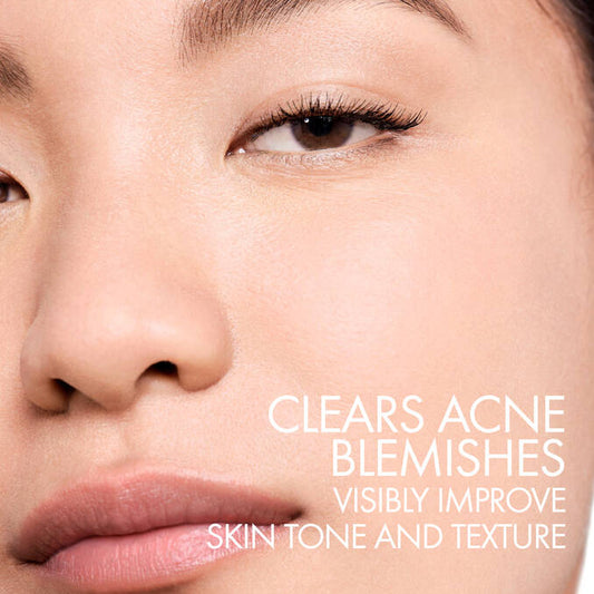 Vichy Normaderm PhytoAction Acne Control Moisturizer with Salicylic Acid