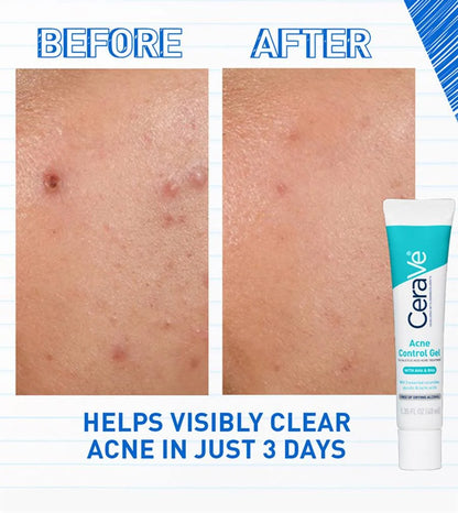 CeraVe Blemish Control Gel 40ML