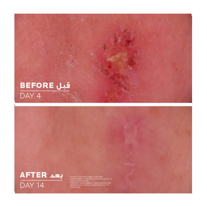 La Roche-Posay Cicaplast Baume B5+