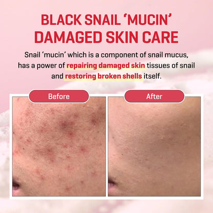 SOME BY MI Snail Truecica Miracle Repair Cream