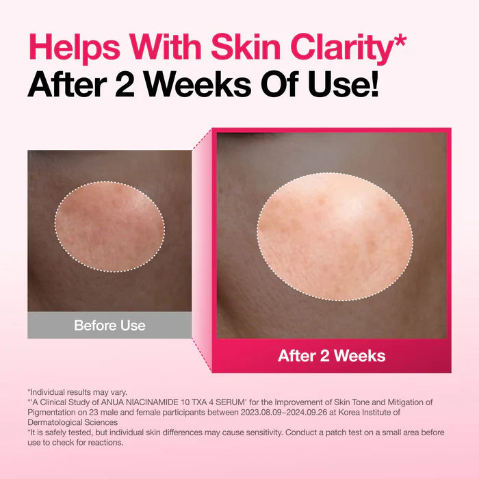The Anua Niacinamide 10% + TXA 4% Dark Spot Correcting Serum