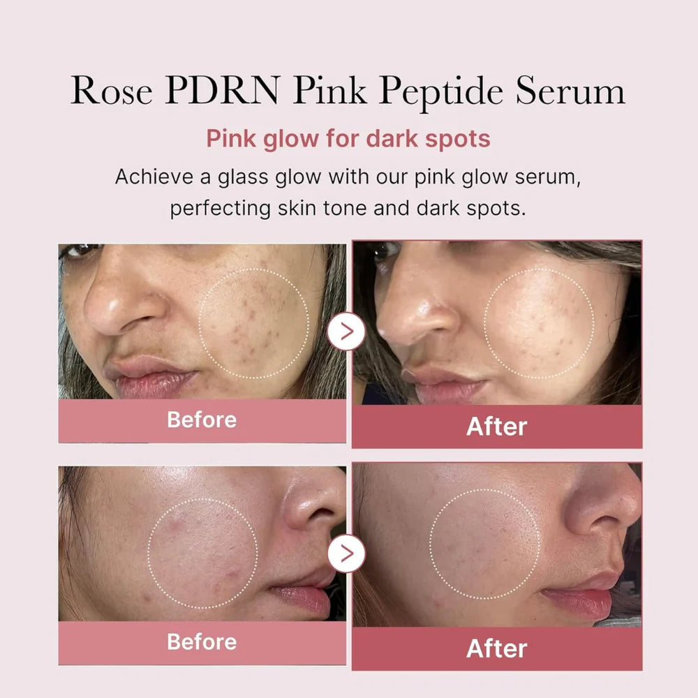 Medicube PDRN Pink Peptide Serum 30m