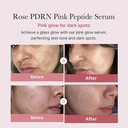 Medicube PDRN Pink Peptide Serum 30m